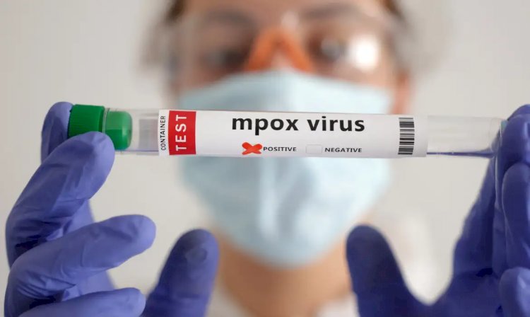 OMS estima custo de US$ 135 milhões em 6 meses para conter mpox