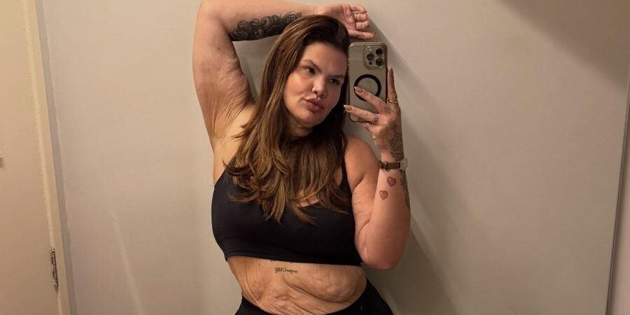 Thais Carla planeja cirurgias reparadoras após perder mais de 100 kg e prepara livro e documentário